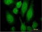 RAB3A Antibody (monoclonal) (M01)