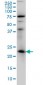 RAB3A Antibody (monoclonal) (M01)