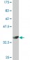 RAB5A Antibody (monoclonal) (M09A)