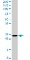 RAB6A Antibody (monoclonal) (M01)