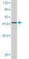 RAB7L1 Antibody (monoclonal) (M03)