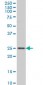 RAB7L1 Antibody (monoclonal) (M03)