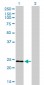 RAB7L1 Antibody (monoclonal) (M03)