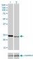 RAB7L1 Antibody (monoclonal) (M03)