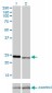 RAB7L1 Antibody (monoclonal) (M03)