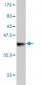 RAB9A Antibody (monoclonal) (M01)