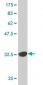 RAD1 Antibody (monoclonal) (M01)