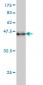 RAD17 Antibody (monoclonal) (M01)