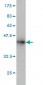 RAD18 Antibody (monoclonal) (M01)