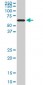 RAD18 Antibody (monoclonal) (M01)