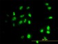 RAD18 Antibody (monoclonal) (M01)