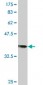 RAD18 Antibody (monoclonal) (M03)