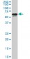 RAD18 Antibody (monoclonal) (M03)