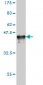 RAD23A Antibody (monoclonal) (M01)