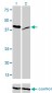 RAD23A Antibody (monoclonal) (M01)