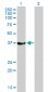 RAD51 Antibody (monoclonal) (M01)