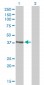 RAD51C Antibody (monoclonal) (M01)