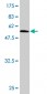 RAD51L3 Antibody (monoclonal) (M02)