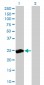 RALB Antibody (monoclonal) (M04)