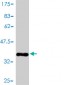RAMP3 Antibody (monoclonal) (M01)