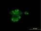 RARA Antibody (monoclonal) (M01)