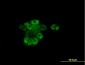 RARA Antibody (monoclonal) (M01)