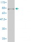 RARA Antibody (monoclonal) (M01)