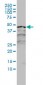 RARA Antibody (monoclonal) (M01)