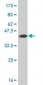 RARA Antibody (monoclonal) (M03)