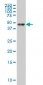 RARA Antibody (monoclonal) (M03)