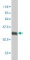 RARB Antibody (monoclonal) (M01)