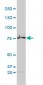 RARS Antibody (monoclonal) (M01)