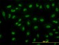 RBBP4 Antibody (monoclonal) (M01)