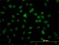 RBBP4 Antibody (monoclonal) (M02)