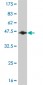 RBM5 Antibody (monoclonal) (M01)