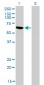 RBM5 Antibody (monoclonal) (M01)