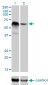 RBM5 Antibody (monoclonal) (M01)