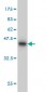 RBM9 Antibody (monoclonal) (M01)