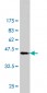 RBP4 Antibody (monoclonal) (M03)