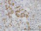 RBP4 Antibody (monoclonal) (M05)