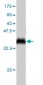 RCHY1 Antibody (monoclonal) (M01)