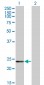 RCV1 Antibody (monoclonal) (M05)