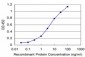 RCV1 Antibody (monoclonal) (M07)