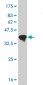 RCV1 Antibody (monoclonal) (M07)