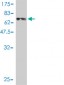 REN Antibody (monoclonal) (M01)