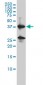 REN Antibody (monoclonal) (M01)