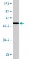 RGS4 Antibody (monoclonal) (M01)