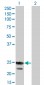 RGS4 Antibody (monoclonal) (M01)