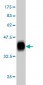 RHCG Antibody (monoclonal) (M06)