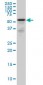 RHCG Antibody (monoclonal) (M06)